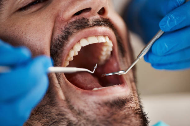 Best Emergency Dentist for Knocked-Out Tooth in Oceana, WV