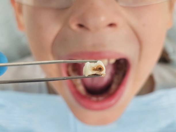 Best Emergency Dentist for Special Needs Patients in Oceana, WV